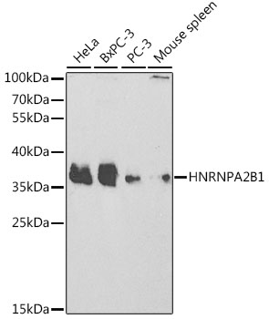 Lane 1: Human Hela cell lysates; Lane 2: Human BxPC_x000D_ -3 cell lysates; Lane 3: Human PC-3 cell lysates; Lane 4: Mouse Spleen lysates probed with HNRNPA2B1 Polyclonal Antibody, Unconjugated (bs-55101R) at 1:1000 dilution and 4˚C overnight incubation. Followed by conjugated secondary antibody incubation at 1:20000 for 60 min at 37˚C.