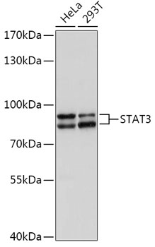 Lane 1: Human Hela cell lysates; Lane 2: Human 293T cell lysates probed with STAT3 Polyclonal Antibody, Unconjugated (bs-55208R) at 1:1000 dilution and 4˚C overnight incubation. Followed by conjugated secondary antibody incubation at 1:20000 for 60 min at 37˚C.