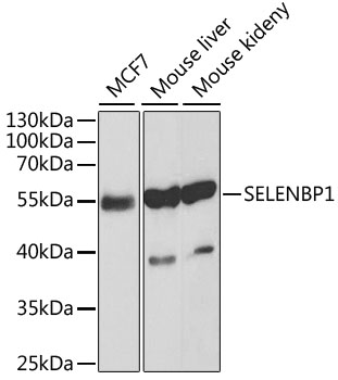 Lane 1: Human MCF-7 cell lysates; Lane 2: Mouse Liver lysates; Lane 3: Mouse kidney lysates probed with SELENBP1 Polyclonal Antibody, Unconjugated (bs-55195R) at 1:1000 dilution and 4˚C overnight incubation. Followed by conjugated secondary antibody incubation at 1:20000 for 60 min at 37˚C.