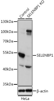 Lane 1: Hela cell lysates; Lane 2: SELENBP1 knockout (KO) HeLa cell lysates probed with SELENBP1 Polyclonal Antibody, Unconjugated (bs-55195R) at 1:1000 dilution and 4˚C overnight incubation. Followed by conjugated secondary antibody incubation at 1:20000 for 60 min at 37˚C.