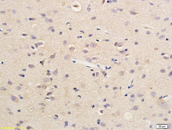 Formalin-fixed and paraffin embedded rat brain labeled with Anti SDHD Polyclonal Antibody, Unconjugated (bs-3971R) followed by conjugation to the secondary antibody and DAB staining