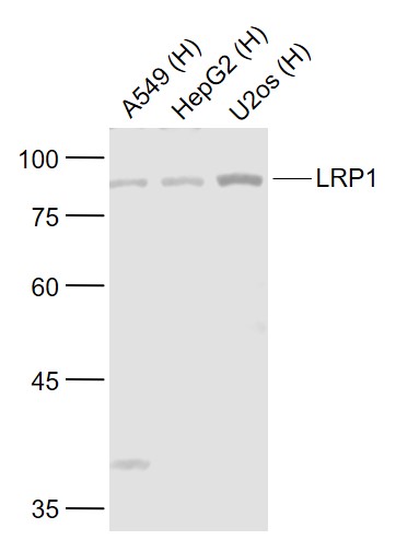 Lane 1: Human A549 cell lysates; Lane 2: Human HepG2 cell lysates; Lane 3: Human U-2OS cell lysates probed with LRP1 Polyclonal Antibody, Unconjugated (bs-10920R) at 1:1000 dilution and 4˚C overnight incubation. Followed by conjugated secondary antibody incubation at 1:20000 for 60 min at 37˚C.