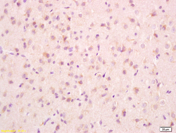 Formalin-fixed and paraffin embedded rat brain tissue labeled with Anti-PCMT1 Polyclonal Antibody, Unconjugated(bs-6211R) at 1:200, followed by conjugation to the secondary antibody and DAB staining