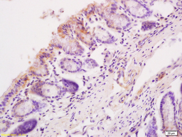 Formalin-fixed and paraffin mouse intestine tissue labeled withAnti-Sema3C/Semaphorin 3c Polyclonal Antibody, Unconjugated(bs-6692R) at 1:200, followed by conjugation to the secondary antibody and DAB staining