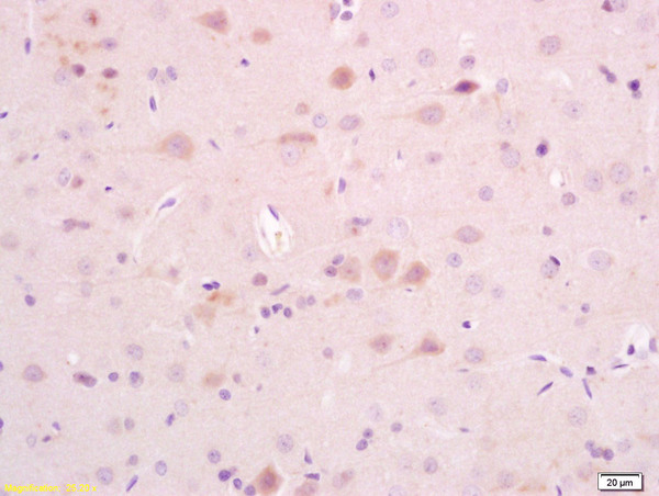Formalin-fixed and paraffin rat brain tissue labeled with Anti-AKAP5 Polyclonal Antibody, Unconjugated(bs-6980R) at 1:200, followed by conjugation to the secondary antibody and DAB staining