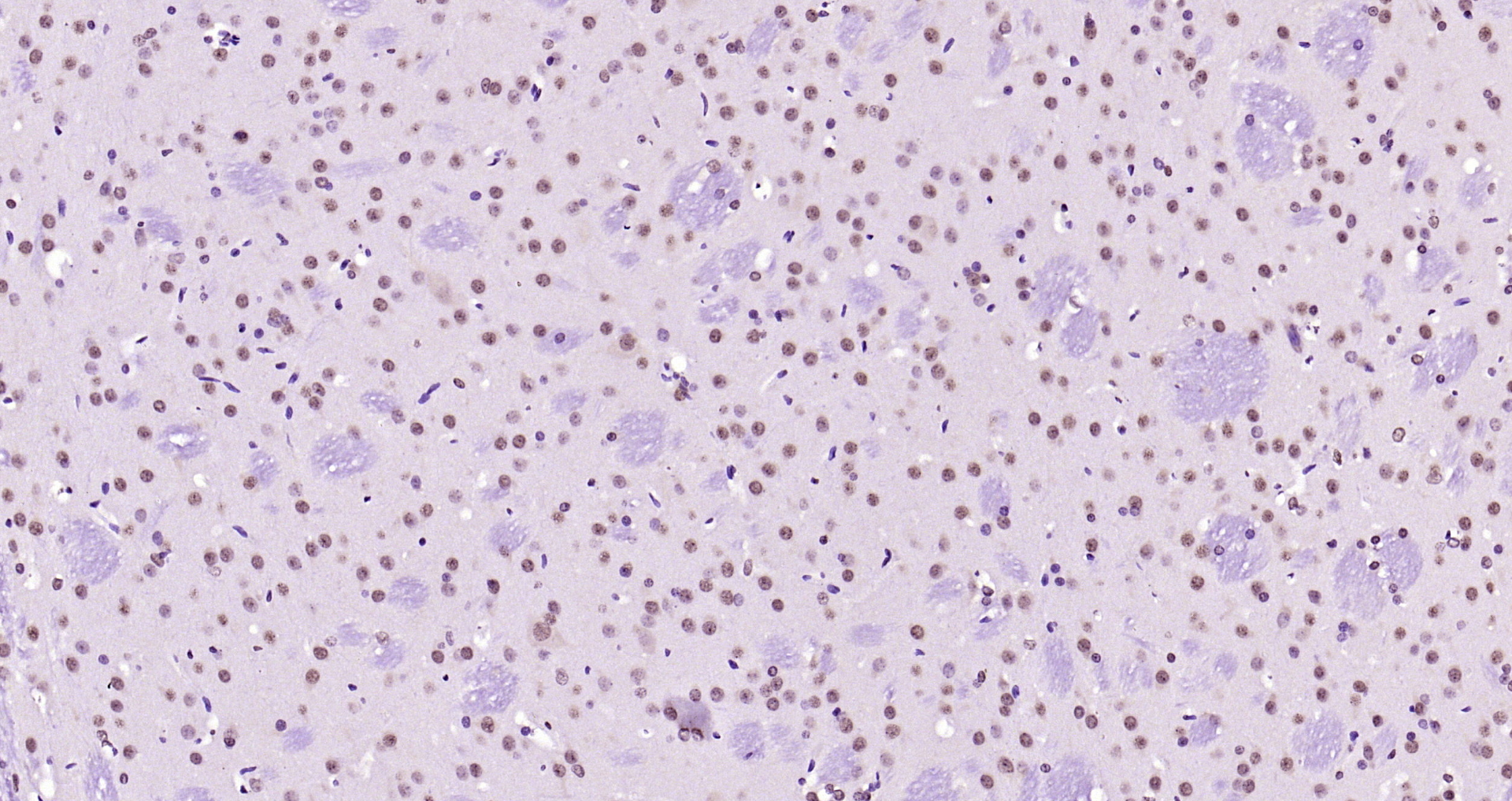 Paraformaldehyde-fixed, paraffin embedded Rat brain; Antigen retrieval by boiling in sodium citrate buffer (pH6.0) for 15min; Block endogenous peroxidase by 3% hydrogen peroxide for 20 minutes; Blocking buffer (normal goat serum) at 37°C for 30min; Antibody incubation with SOX9 Polyclonal Antibody, Unconjugated (bs-10725R) at 1:200 overnight at 4°C, DAB staining.