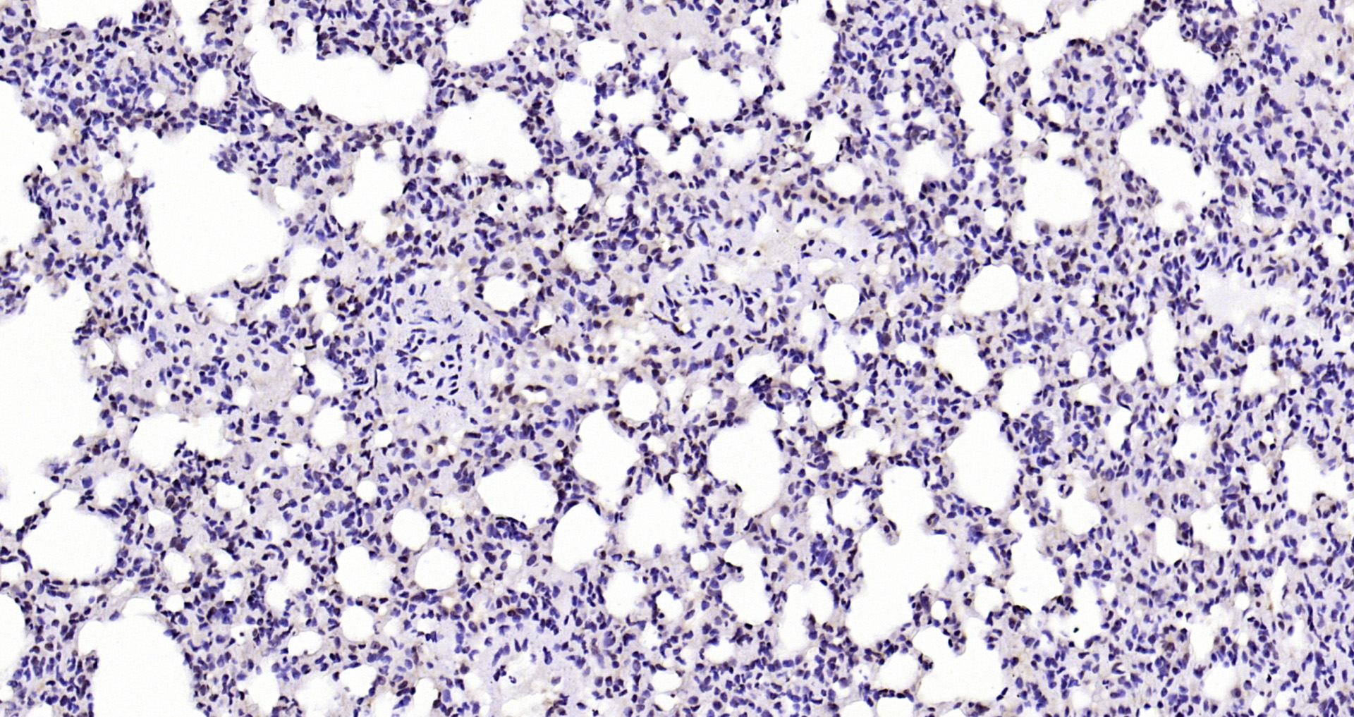 Paraformaldehyde-fixed, paraffin embedded Mouse lung; Antigen retrieval by boiling in sodium citrate buffer (pH6.0) for 15min; Block endogenous peroxidase by 3% hydrogen peroxide for 20 minutes; Blocking buffer (normal goat serum) at 37°C for 30min; Antibody incubation with AKT1 (11F2) Monoclonal Antibody, Unconjugated (bsm-52010R) at 1:200 overnight at 4°C, DAB staining.