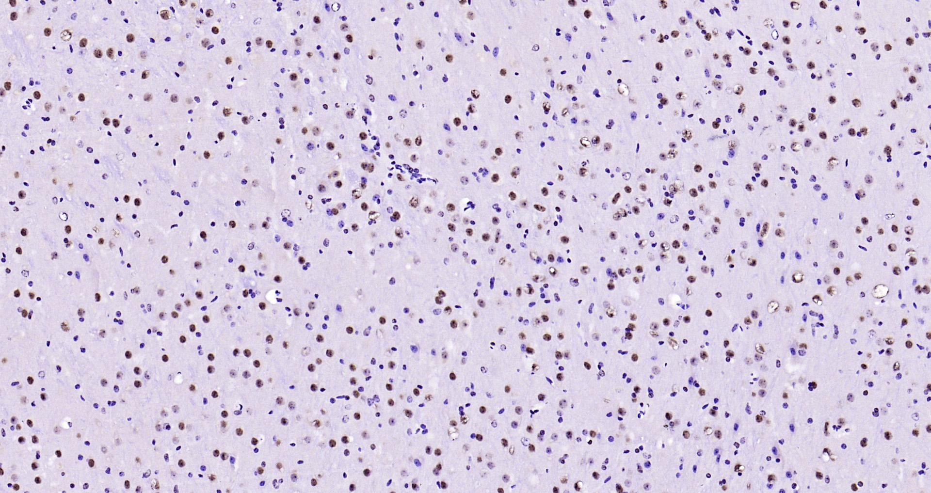 Paraformaldehyde-fixed, paraffin embedded Mouse brain; Antigen retrieval by boiling in sodium citrate buffer (pH6.0) for 15min; Block endogenous peroxidase by 3% hydrogen peroxide for 20 minutes; Blocking buffer (normal goat serum) at 37°C for 30min; Antibody incubation with AKT1 (11F2) Monoclonal Antibody, Unconjugated (bsm-52010R) at 1:200 overnight at 4°C, DAB staining.