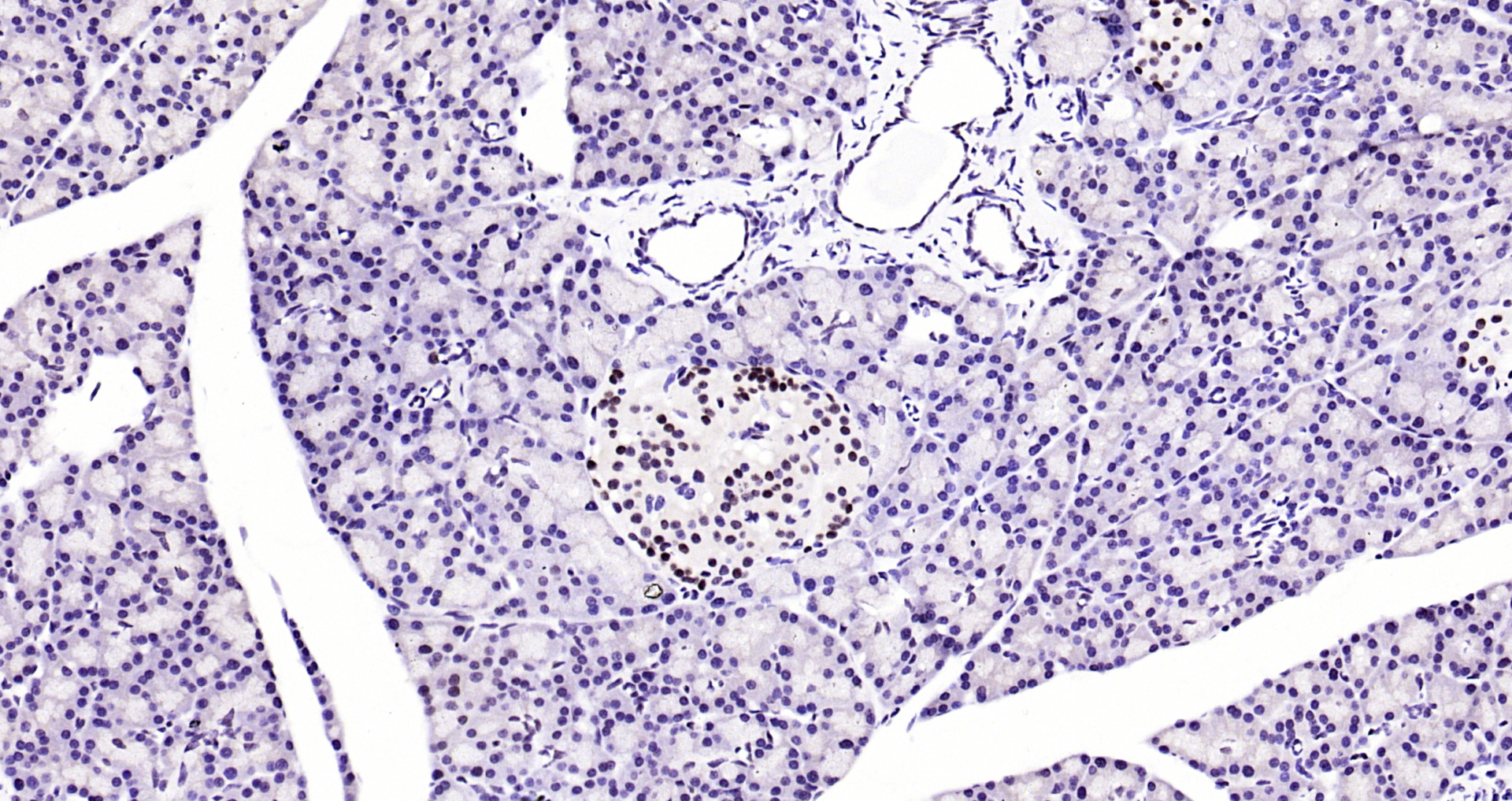 Paraformaldehyde-fixed, paraffin embedded Mouse pancreas; Antigen retrieval by boiling in sodium citrate buffer (pH6.0) for 15min; Block endogenous peroxidase by 3% hydrogen peroxide for 20 minutes; Blocking buffer (normal goat serum) at 37°C for 30min; Antibody incubation with AKT1 (11F2) Monoclonal Antibody, Unconjugated (bsm-52010R) at 1:200 overnight at 4°C, DAB staining.
