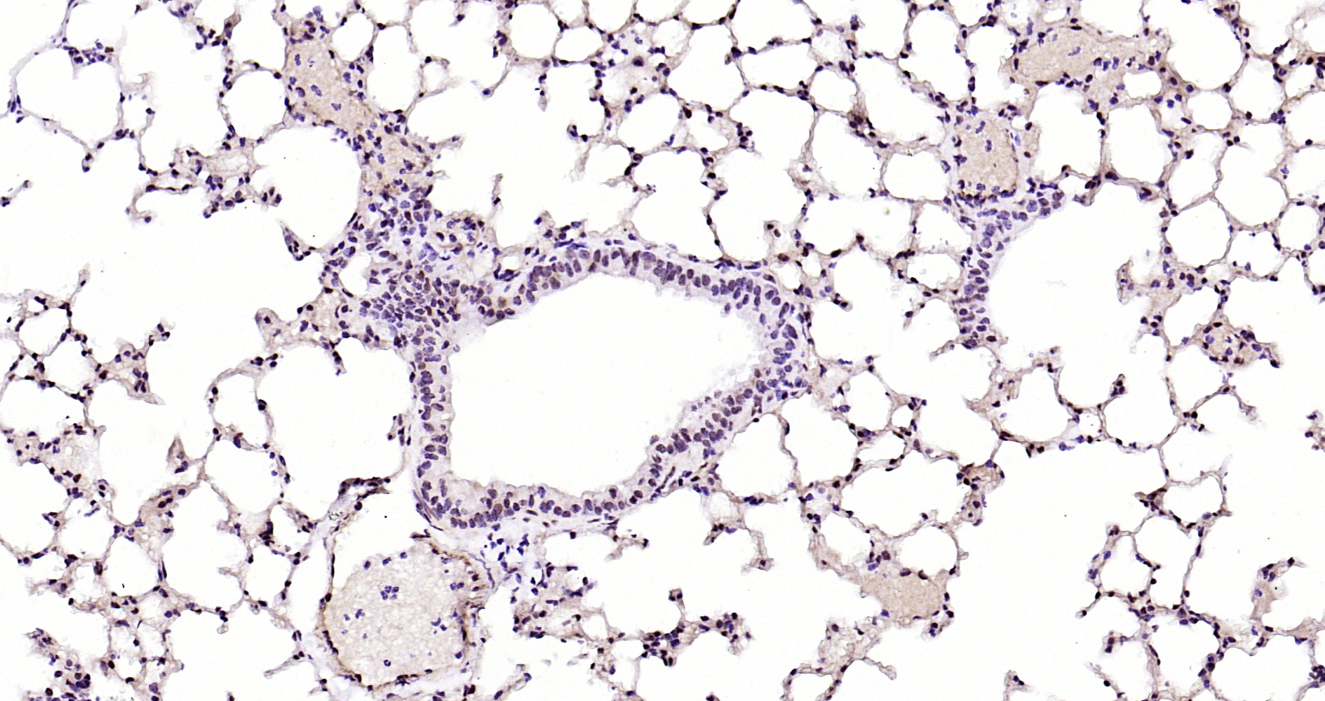 Paraformaldehyde-fixed, paraffin embedded Rat lung; Antigen retrieval by boiling in sodium citrate buffer (pH6.0) for 15min; Block endogenous peroxidase by 3% hydrogen peroxide for 20 minutes; Blocking buffer (normal goat serum) at 37°C for 30min; Antibody incubation with AKT1 (11F2) Monoclonal Antibody, Unconjugated (bsm-52010R) at 1:200 overnight at 4°C, DAB staining.