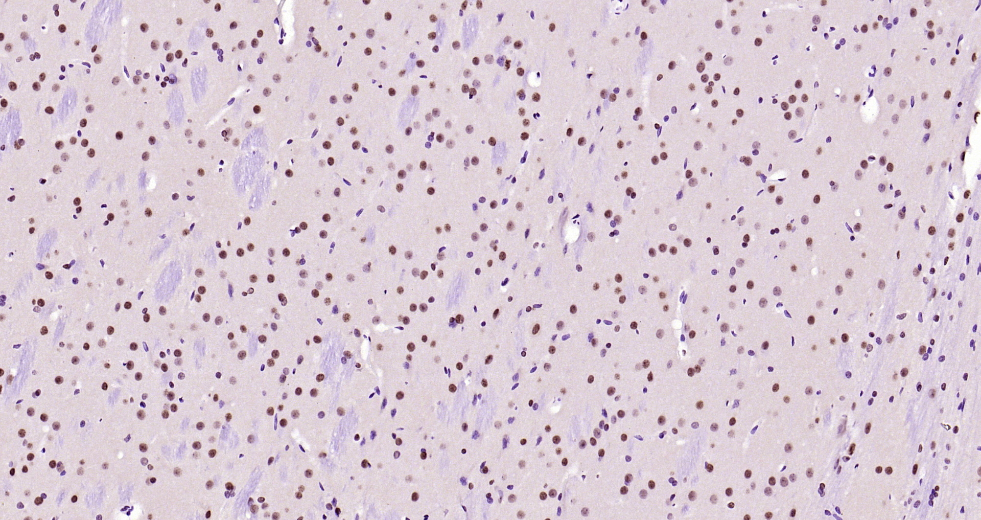 Paraformaldehyde-fixed, paraffin embedded Rat brain; Antigen retrieval by boiling in sodium citrate buffer (pH6.0) for 15min; Block endogenous peroxidase by 3% hydrogen peroxide for 20 minutes; Blocking buffer (normal goat serum) at 37°C for 30min; Antibody incubation with AKT1 (11F2) Monoclonal Antibody, Unconjugated (bsm-52010R) at 1:200 overnight at 4°C, DAB staining.