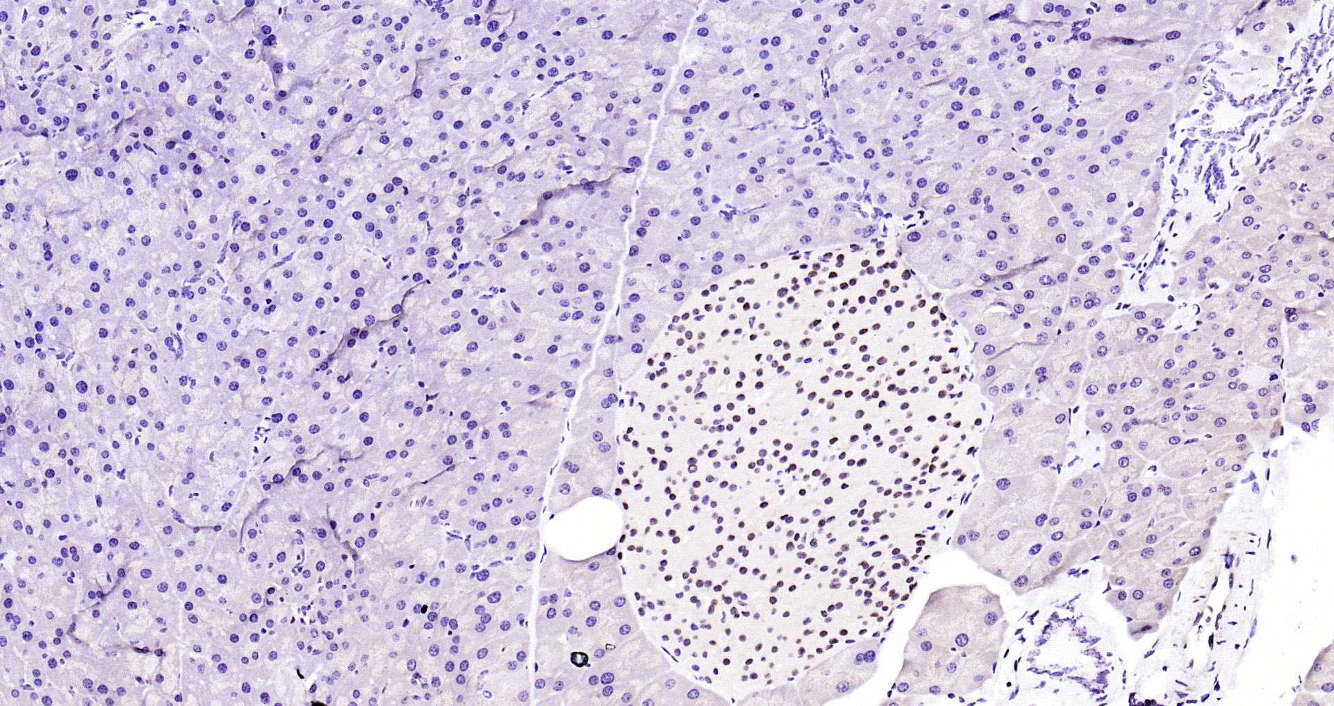 Paraformaldehyde-fixed, paraffin embedded Rat pancreas; Antigen retrieval by boiling in sodium citrate buffer (pH6.0) for 15min; Block endogenous peroxidase by 3% hydrogen peroxide for 20 minutes; Blocking buffer (normal goat serum) at 37°C for 30min; Antibody incubation with AKT1 (11F2) Monoclonal Antibody, Unconjugated (bsm-52010R) at 1:200 overnight at 4°C, DAB staining.