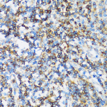 Paraformaldehyde-fixed, paraffin embedded Human tonsil; Antigen retrieval by boiling in sodium citrate buffer (pH6.0) for 15min; Block endogenous peroxidase by 3% hydrogen peroxide for 20 minutes; Blocking buffer (normal goat serum) at 37°C for 30min; Antibody incubation with ARHGEF1 Polyclonal Antibody, Unconjugated (bs-55014R) at 1:100 overnight at 4°C, DAB staining.