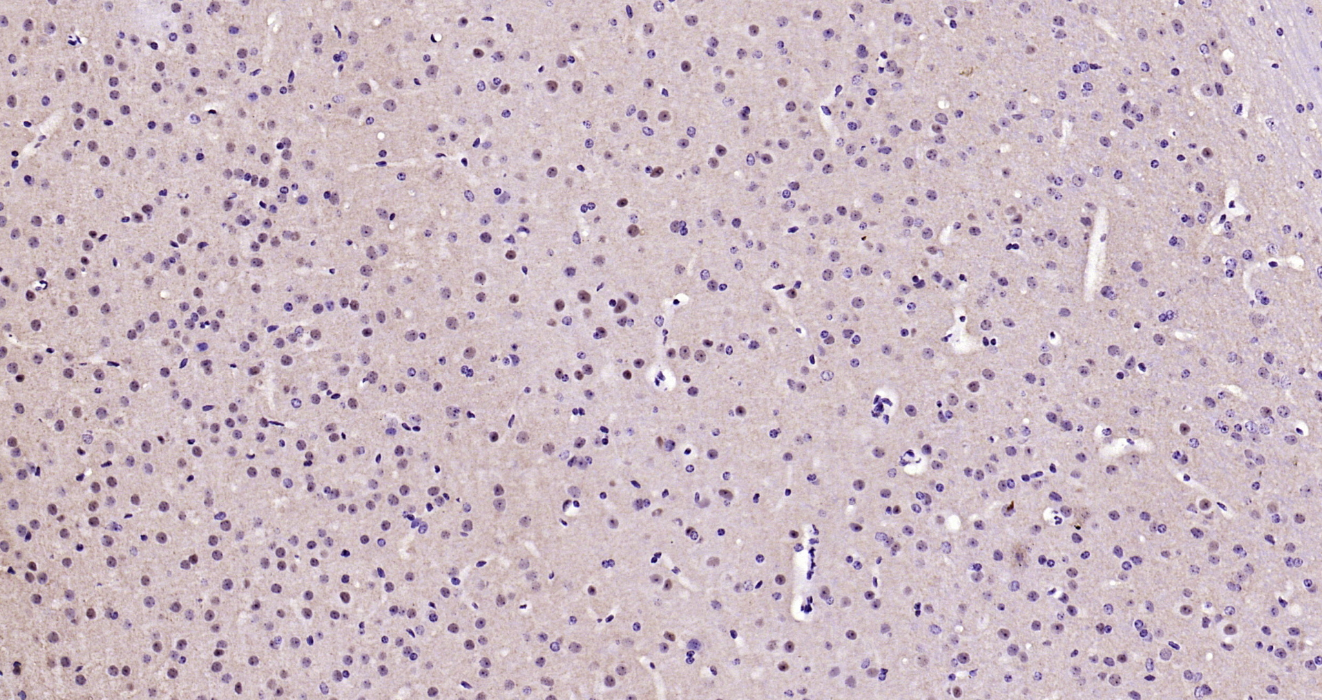 Paraformaldehyde-fixed, paraffin embedded Mouse brain; Antigen retrieval by boiling in sodium citrate buffer (pH6.0) for 15min; Block endogenous peroxidase by 3% hydrogen peroxide for 20 minutes; Blocking buffer (normal goat serum) at 37°C for 30min; Antibody incubation with phospho-Alpha synuclein(Ser129) Monoclonal Antibody, Unconjugated (bsm-41203M) at 1:200 overnight at 4°C, DAB staining.