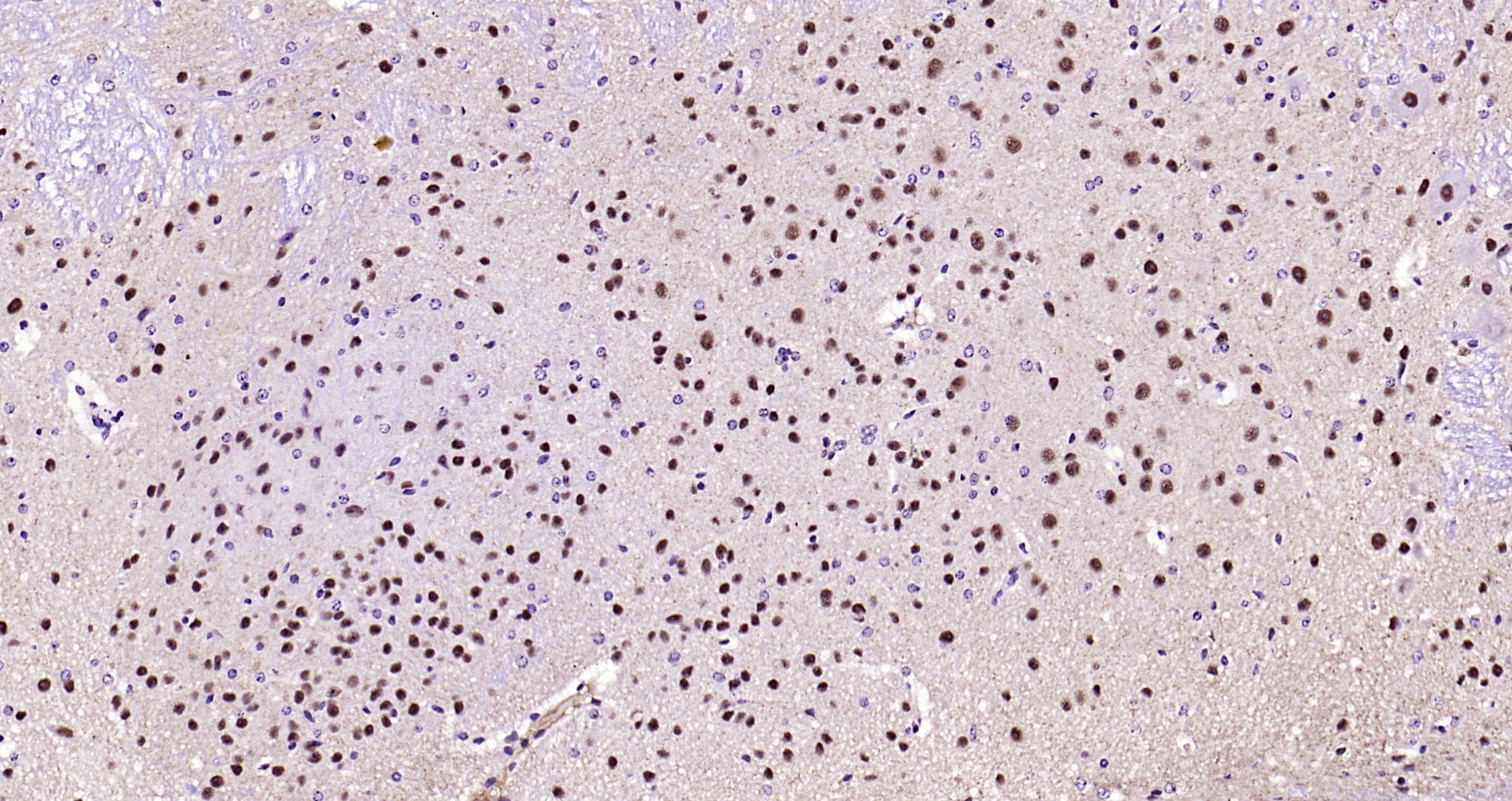 Paraformaldehyde-fixed, paraffin embedded Mouse cerebellum; Antigen retrieval by boiling in sodium citrate buffer (pH6.0) for 15min; Block endogenous peroxidase by 3% hydrogen peroxide for 20 minutes; Blocking buffer (normal goat serum) at 37°C for 30min; Antibody incubation with phospho-Alpha synuclein(Ser129) Monoclonal Antibody, Unconjugated (bsm-41203M) at 1:200 overnight at 4°C, DAB staining.