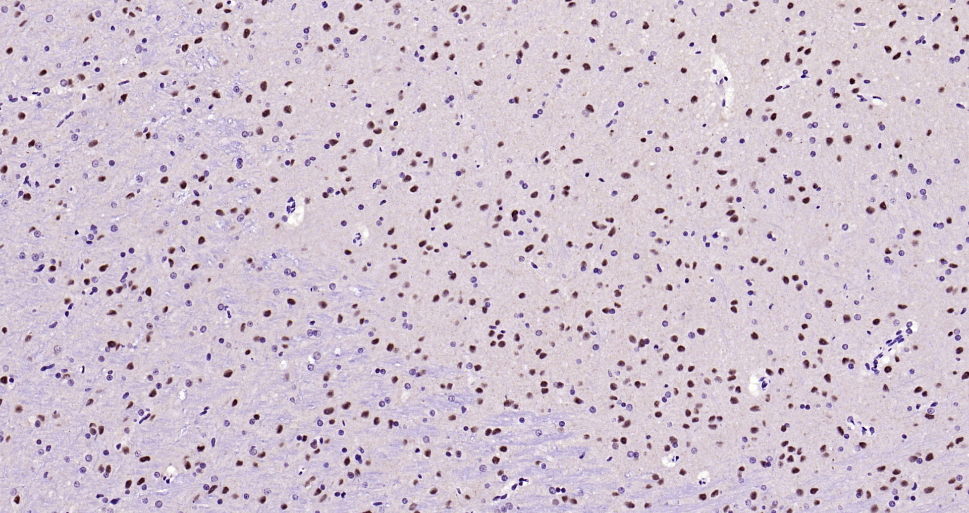 Paraformaldehyde-fixed, paraffin embedded Rat brain; Antigen retrieval by boiling in sodium citrate buffer (pH6.0) for 15min; Block endogenous peroxidase by 3% hydrogen peroxide for 20 minutes; Blocking buffer (normal goat serum) at 37°C for 30min; Antibody incubation with phospho-Alpha synuclein(Ser129) Monoclonal Antibody, Unconjugated (bsm-41203M) at 1:200 overnight at 4°C, DAB staining.