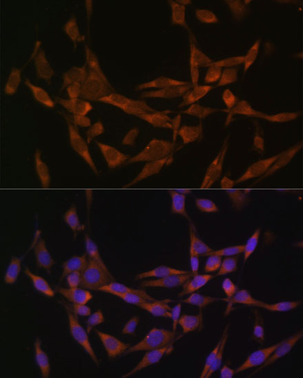Tissue/cell: Hela cell; 4% Paraformaldehyde-fixed; Triton X-100 at room temperature for 20 min; Blocking buffer (normal goat serum, C-0005) at 37°C for 20 min; Antibody incubation with (UBE2O) polyclonal Antibody, Unconjugated (bs-55219) 1:100, 90 minutes at 37°C; followed by a conjugated Goat Anti-Rabbit IgG antibody at 37°C for 90 minutes, DAPI (blue, C02-04002) was used to stain the cell nuc