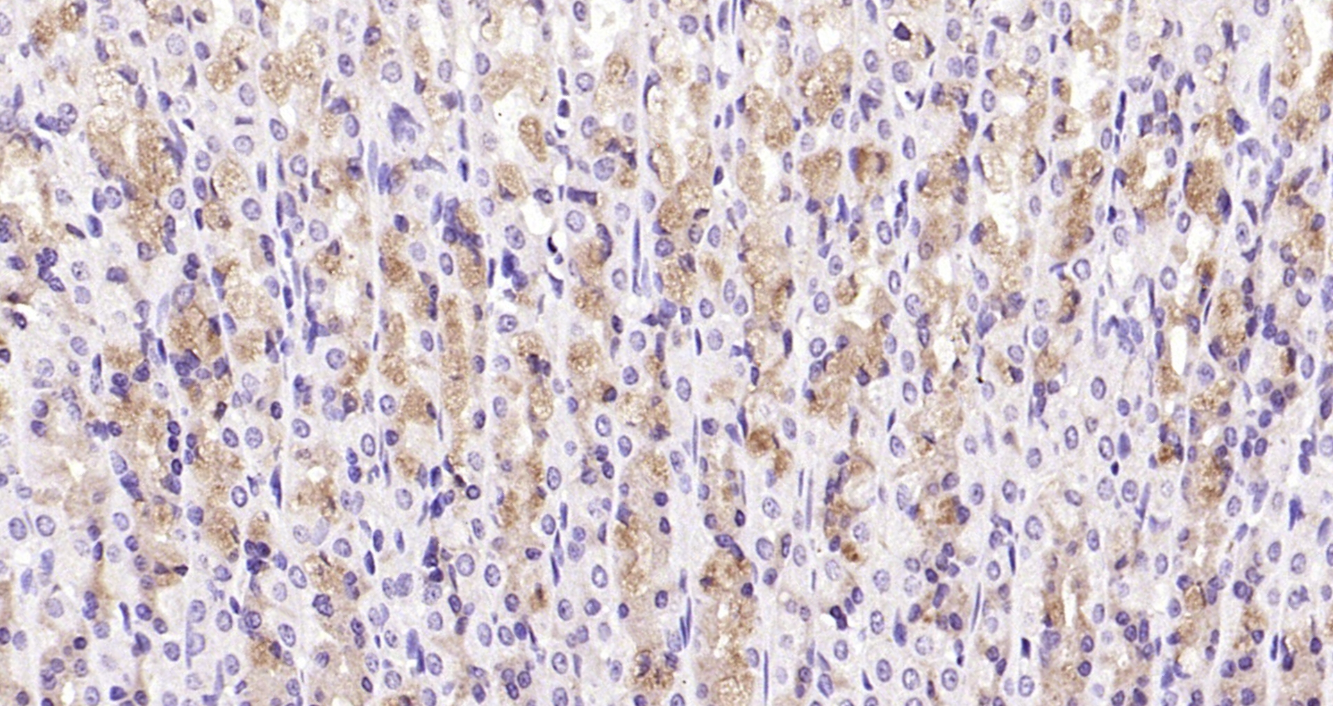 Paraformaldehyde-fixed, paraffin embedded Rat stomach; Antigen retrieval by boiling in sodium citrate buffer (pH6.0) for 15min; Block endogenous peroxidase by 3% hydrogen peroxide for 20 minutes; Blocking buffer (normal goat serum) at 37°C for 30min; Antibody incubation with TAK1 Polyclonal Antibody, Unconjugated (bs-3585R) at 1:200 overnight at 4°C, DAB staining.