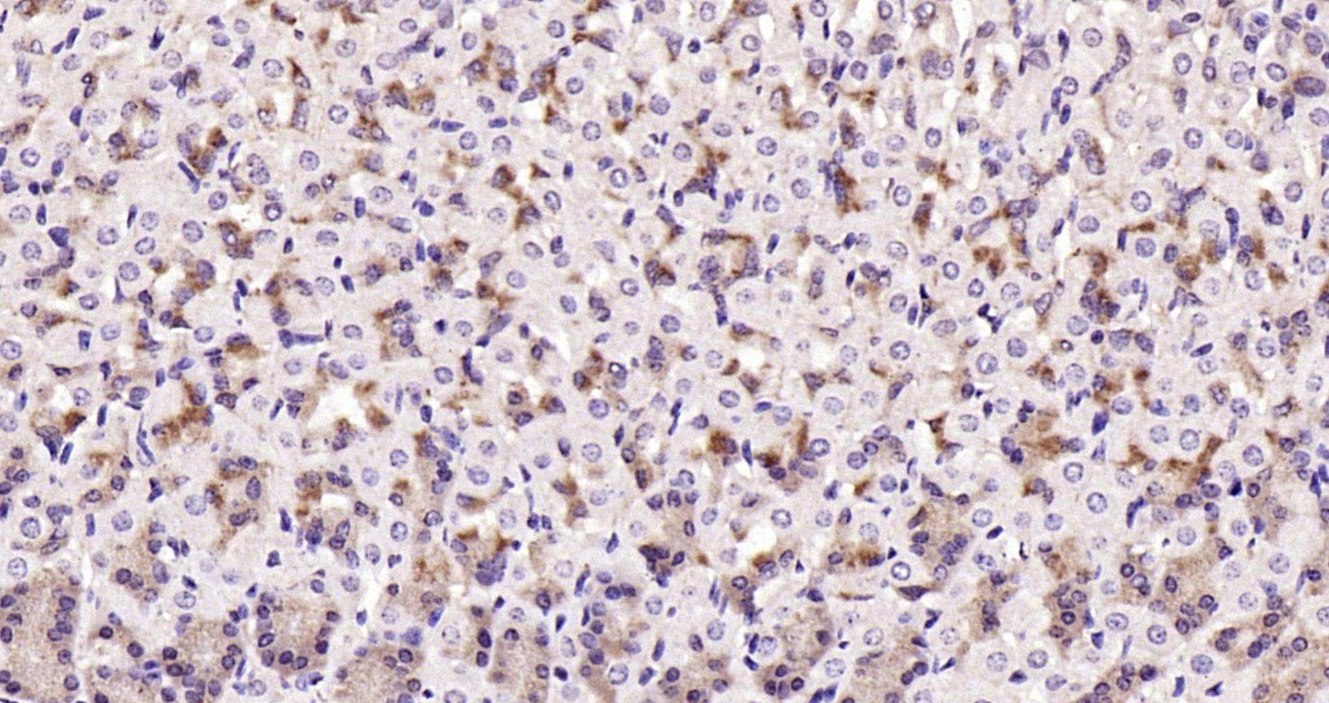 Paraformaldehyde-fixed, paraffin embedded Mouse stomach; Antigen retrieval by boiling in sodium citrate buffer (pH6.0) for 15min; Block endogenous peroxidase by 3% hydrogen peroxide for 20 minutes; Blocking buffer (normal goat serum) at 37°C for 30min; Antibody incubation with TAK1 Polyclonal Antibody, Unconjugated (bs-3585R) at 1:200 overnight at 4°C, DAB staining.