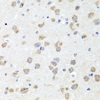 Paraformaldehyde-fixed, paraffin embedded Mouse brain; Antigen retrieval by boiling in sodium citrate buffer (pH6.0) for 15min; Block endogenous peroxidase by 3% hydrogen peroxide for 20 minutes; Blocking buffer (normal goat serum) at 37°C for 30min; Antibody incubation with CHD1 Polyclonal Antibody, Unconjugated (bs-55043R) at 1:100 overnight at 4°C, DAB staining.