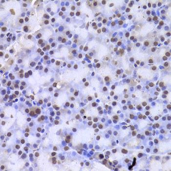Paraformaldehyde-fixed, paraffin embedded Rat pancreas; Antigen retrieval by boiling in sodium citrate buffer (pH6.0) for 15min; Block endogenous peroxidase by 3% hydrogen peroxide for 20 minutes; Blocking buffer (normal goat serum) at 37°C for 30min; Antibody incubation with CSNK1E Polyclonal Antibody, Unconjugated (bs-55048R) at 1:200 overnight at 4°C, DAB staining.
