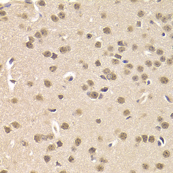 Paraformaldehyde-fixed, paraffin embedded Mouse brain; Antigen retrieval by boiling in sodium citrate buffer (pH6.0) for 15min; Block endogenous peroxidase by 3% hydrogen peroxide for 20 minutes; Blocking buffer (normal goat serum) at 37°C for 30min; Antibody incubation with CSNK1E Polyclonal Antibody, Unconjugated (bs-55048R) at 1:200 overnight at 4°C, DAB staining.