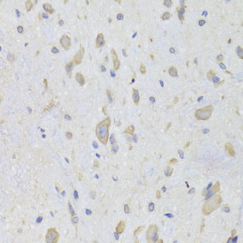 Paraformaldehyde-fixed, paraffin embedded Rat spinal cord; Antigen retrieval by boiling in sodium citrate buffer (pH6.0) for 15min; Block endogenous peroxidase by 3% hydrogen peroxide for 20 minutes; Blocking buffer (normal goat serum) at 37°C for 30min; Antibody incubation with EEF1B2 Polyclonal Antibody, Unconjugated (bs-55059R) at 1:100 overnight at 4°C, DAB staining.