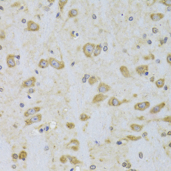 Paraformaldehyde-fixed, paraffin embedded Rat brain; Antigen retrieval by boiling in sodium citrate buffer (pH6.0) for 15min; Block endogenous peroxidase by 3% hydrogen peroxide for 20 minutes; Blocking buffer (normal goat serum) at 37°C for 30min; Antibody incubation with EEF1B2 Polyclonal Antibody, Unconjugated (bs-55059R) at 1:100 overnight at 4°C, DAB staining.