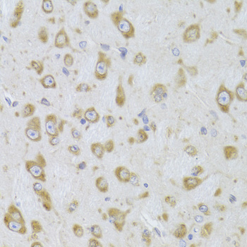 Paraformaldehyde-fixed, paraffin embedded Mouse brain; Antigen retrieval by boiling in sodium citrate buffer (pH6.0) for 15min; Block endogenous peroxidase by 3% hydrogen peroxide for 20 minutes; Blocking buffer (normal goat serum) at 37°C for 30min; Antibody incubation with EEF1B2 Polyclonal Antibody, Unconjugated (bs-55059R) at 1:100 overnight at 4°C, DAB staining.