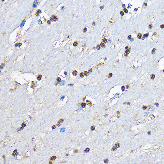 Paraformaldehyde-fixed, paraffin embedded Mouse brain; Antigen retrieval by boiling in sodium citrate buffer (pH6.0) for 15min; Block endogenous peroxidase by 3% hydrogen peroxide for 20 minutes; Blocking buffer (normal goat serum) at 37°C for 30min; Antibody incubation with EGLN1 Polyclonal Antibody, Unconjugated (bs-55063R) at 1:100 overnight at 4°C, DAB staining.