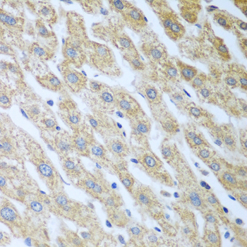 Paraformaldehyde-fixed, paraffin embedded Human liver; Antigen retrieval by boiling in sodium citrate buffer (pH6.0) for 15min; Block endogenous peroxidase by 3% hydrogen peroxide for 20 minutes; Blocking buffer (normal goat serum) at 37°C for 30min; Antibody incubation with Eif2ak2 Polyclonal Antibody, Unconjugated (bs-55064R) at 1:100 overnight at 4°C, DAB staining.