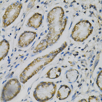 Paraformaldehyde-fixed, paraffin embedded Human stomach; Antigen retrieval by boiling in sodium citrate buffer (pH6.0) for 15min; Block endogenous peroxidase by 3% hydrogen peroxide for 20 minutes; Blocking buffer (normal goat serum) at 37°C for 30min; Antibody incubation with GLUL Polyclonal Antibody, Unconjugated (bs-55085R) at 1:100 overnight at 4°C, DAB staining. Paraformaldehyde-fixed, paraffin embedded Human stomach; Antigen retrieval by boiling in sodium citrate buffer (pH6.0) for 15min; Block endogenous peroxidase by 3% hydrogen peroxide for 20 minutes; Blocking buffer (normal goat serum) at 37°C for 30min; Antibody incubation with GLUL Polyclonal Antibody, Unconjugated (bs-55085R) at 1:100 overnight at 4°C, DAB staining.