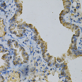 Paraformaldehyde-fixed, paraffin embedded Mouse lung; Antigen retrieval by boiling in sodium citrate buffer (pH6.0) for 15min; Block endogenous peroxidase by 3% hydrogen peroxide for 20 minutes; Blocking buffer (normal goat serum) at 37°C for 30min; Antibody incubation with GLUL Polyclonal Antibody, Unconjugated (bs-55085R) at 1:100 overnight at 4°C, DAB staining.