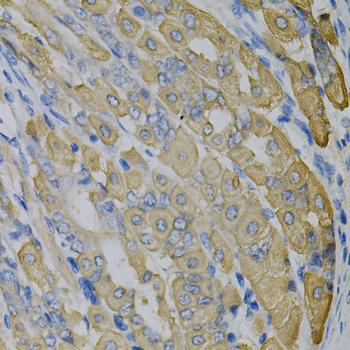 Paraformaldehyde-fixed, paraffin embedded Mouse stomach; Antigen retrieval by boiling in sodium citrate buffer (pH6.0) for 15min; Block endogenous peroxidase by 3% hydrogen peroxide for 20 minutes; Blocking buffer (normal goat serum) at 37°C for 30min; Antibody incubation with GLUL Polyclonal Antibody, Unconjugated (bs-55085R) at 1:100 overnight at 4°C, DAB staining.