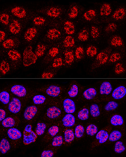 Hela cell; 4% Paraformaldehyde-fixed; Triton X-100 at room temperature for 20 min; Blocking buffer (normal goat serum, C-0005) at 37°C for 20 min; Antibody incubation with (HNRNPA2B1) polyclonal Antibody, Unconjugated (bs-55101R) 1:100, 90 minutes at 37°C; followed by a conjugated Goat Anti-Rabbit IgG antibody at 37°C for 90 minutes, DAPI (blue, C02-04002) was used to stain the cell nuclei.