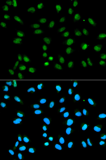 Hela cell; 4% Paraformaldehyde-fixed; Triton X-100 at room temperature for 20 min; Blocking buffer (normal goat serum, C-0005) at 37°C for 20 min; Antibody incubation with (HNRNPA2B1) polyclonal Antibody, Unconjugated (bs-55101R) 1:100, 90 minutes at 37°C; followed by a conjugated Goat Anti-Rabbit IgG antibody at 37°C for 90 minutes, DAPI (blue, C02-04002) was used to stain the cell nuclei.