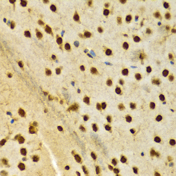 Paraformaldehyde-fixed, paraffin embedded Rat brain; Antigen retrieval by boiling in sodium citrate buffer (pH6.0) for 15min; Block endogenous peroxidase by 3% hydrogen peroxide for 20 minutes; Blocking buffer (normal goat serum) at 37°C for 30min; Antibody incubation with HNRNPA2B1 Polyclonal Antibody, Unconjugated (bs-55101R) at 1:100 overnight at 4°C, DAB staining.
