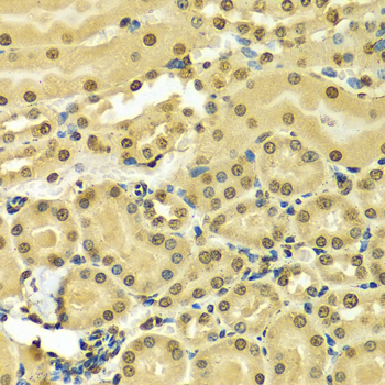 Paraformaldehyde-fixed, paraffin embedded Mouse kidney; Antigen retrieval by boiling in sodium citrate buffer (pH6.0) for 15min; Block endogenous peroxidase by 3% hydrogen peroxide for 20 minutes; Blocking buffer (normal goat serum) at 37°C for 30min; Antibody incubation with HNRNPA2B1 Polyclonal Antibody, Unconjugated (bs-55101R) at 1:100 overnight at 4°C, DAB staining.