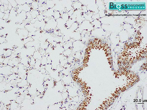 Formalin-fixed and paraffin embedded mouse lung tissue labeled Anti-SP-D Polyclonal Antibody, Unconjugated (bs-1583R) at 1:2000, followed by conjugation to the secondary antibody and DAB staining