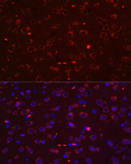 Rat brain cell; 4% Paraformaldehyde-fixed; Triton X-100 at room temperature for 20 min; Blocking buffer (normal goat serum, C-0005) at 37\u00b0C for 20 min; Antibody incubation with (STAT3 ) polyclonal Antibody, Unconjugated (bs-55208R) 1:100, 90 minutes at 37\u00b0C; followed by a conjugated Goat Anti-Rabbit IgG antibody at 37\u00b0C for 90 minutes, DAPI (blue, C02-04002) was used to stain the cell nuclei.