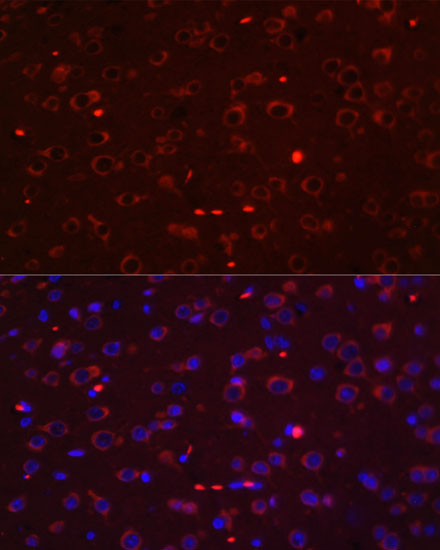 Rat brain cell; 4% Paraformaldehyde-fixed; Triton X-100 at room temperature for 20 min; Blocking buffer (normal goat serum, C-0005) at 37°C for 20 min; Antibody incubation with (STAT3 ) polyclonal Antibody, Unconjugated (bs-55208R) 1:100, 90 minutes at 37°C; followed by a conjugated Goat Anti-Rabbit IgG antibody at 37°C for 90 minutes, DAPI (blue, C02-04002) was used to stain the cell nuclei.