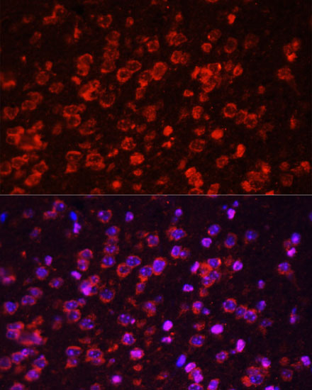 Mouse brain cell; 4% Paraformaldehyde-fixed; Triton X-100 at room temperature for 20 min; Blocking buffer (normal goat serum, C-0005) at 37°C for 20 min; Antibody incubation with (STAT3) polyclonal Antibody, Unconjugated (bs-55208R) 1:100, 90 minutes at 37°C; followed by a conjugated Goat Anti-Rabbit IgG antibody at 37°C for 90 minutes, DAPI (blue, C02-04002) was used to stain the cell nuclei.