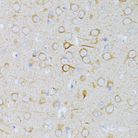 Paraformaldehyde-fixed, paraffin embedded Rat brain; Antigen retrieval by boiling in sodium citrate buffer (pH6.0) for 15min; Block endogenous peroxidase by 3% hydrogen peroxide for 20 minutes; Blocking buffer (normal goat serum) at 37°C for 30min; Antibody incubation with MAP2K1 Polyclonal Antibody, Unconjugated (bs-55126R) at 1:100 overnight at 4°C, DAB staining.