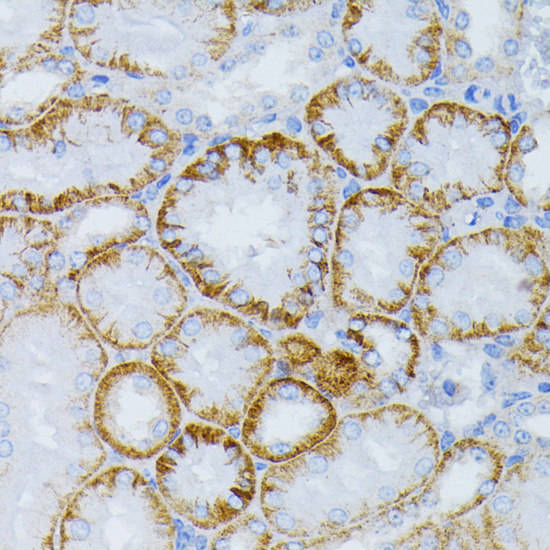 Paraformaldehyde-fixed, paraffin embedded Mouse kidney; Antigen retrieval by boiling in sodium citrate buffer (pH6.0) for 15min; Block endogenous peroxidase by 3% hydrogen peroxide for 20 minutes; Blocking buffer (normal goat serum) at 37°C for 30min; Antibody incubation with MAP2K1 Polyclonal Antibody, Unconjugated (bs-55126R) at 1:100 overnight at 4°C, DAB staining.