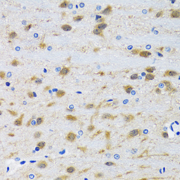 Paraformaldehyde-fixed, paraffin embedded Mouse brain; Antigen retrieval by boiling in sodium citrate buffer (pH6.0) for 15min; Block endogenous peroxidase by 3% hydrogen peroxide for 20 minutes; Blocking buffer (normal goat serum) at 37°C for 30min; Antibody incubation with _x000D_ MAPK9 Polyclonal Antibody, Unconjugated (bs-55130R) at 1:100 overnight at 4°C, DAB staining.