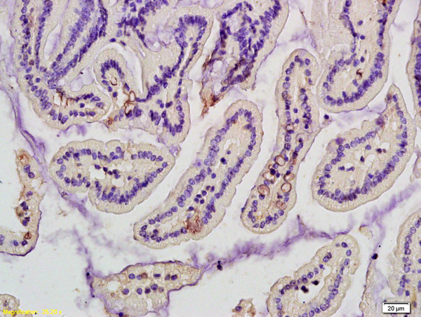 Formalin-fixed and paraffin embedded rat intestine tissue labeled with Anti- Mannan Binding Lectin Polyclonal Antibody, Unconjugated (bs-1582R) at 1:200, followed by conjugation to the secondary antibody and DAB staining.