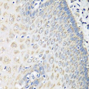 Paraformaldehyde-fixed, paraffin embedded Human esophagus; Antigen retrieval by boiling in sodium citrate buffer (pH6.0) for 15min; Block endogenous peroxidase by 3% hydrogen peroxide for 20 minutes; Blocking buffer (normal goat serum) at 37°C for 30min; Antibody incubation with OXCT1 Polyclonal Antibody, Unconjugated (bs-55159R) at 1:100 overnight at 4°C, DAB staining.