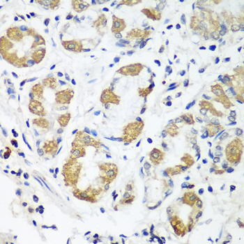 Paraformaldehyde-fixed, paraffin embedded Human stomach; Antigen retrieval by boiling in sodium citrate buffer (pH6.0) for 15min; Block endogenous peroxidase by 3% hydrogen peroxide for 20 minutes; Blocking buffer (normal goat serum) at 37°C for 30min; Antibody incubation with OXCT1 Polyclonal Antibody, Unconjugated (bs-55159R) at 1:100 overnight at 4°C, DAB staining.