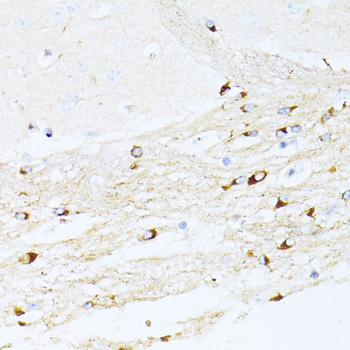 Paraformaldehyde-fixed, paraffin embedded Mouse brain; Antigen retrieval by boiling in sodium citrate buffer (pH6.0) for 15min; Block endogenous peroxidase by 3% hydrogen peroxide for 20 minutes; Blocking buffer (normal goat serum) at 37°C for 30min; Antibody incubation with _x000D_ P21 Polyclonal Antibody, Unconjugated (bs-55160R) at 1:100 overnight at 4°C, DAB staining.