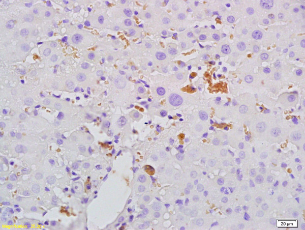 Formalin-fixed and paraffin embedded rat liver tissue labeled with Anti- Mannan Binding Lectin Polyclonal Antibody, Unconjugated (bs-1582R) at 1:200, followed by conjugation to the secondary antibody and DAB staining.